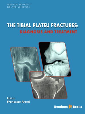 cover image of The Tibial Plateu Fractures: Diagnosis and Treatment